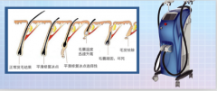 廣州脫毛儀器價格，脫毛一次多少錢，用什么儀器比較好？