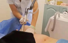 歐洲之星私密激光儀器多少錢一臺(tái)？歐洲之星價(jià)格_私密激光設(shè)備價(jià)格