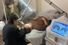 目前祛斑最好的儀器是哪一款？皮秒祛斑儀器多少錢一臺